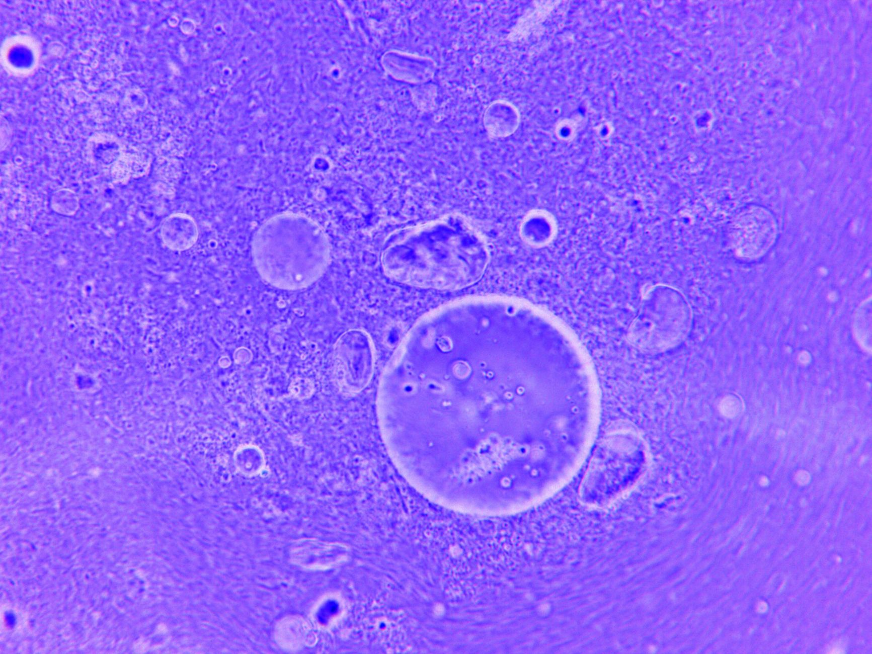 Discovery Reveals Collagen's Surprising Liquid State Inside Cells