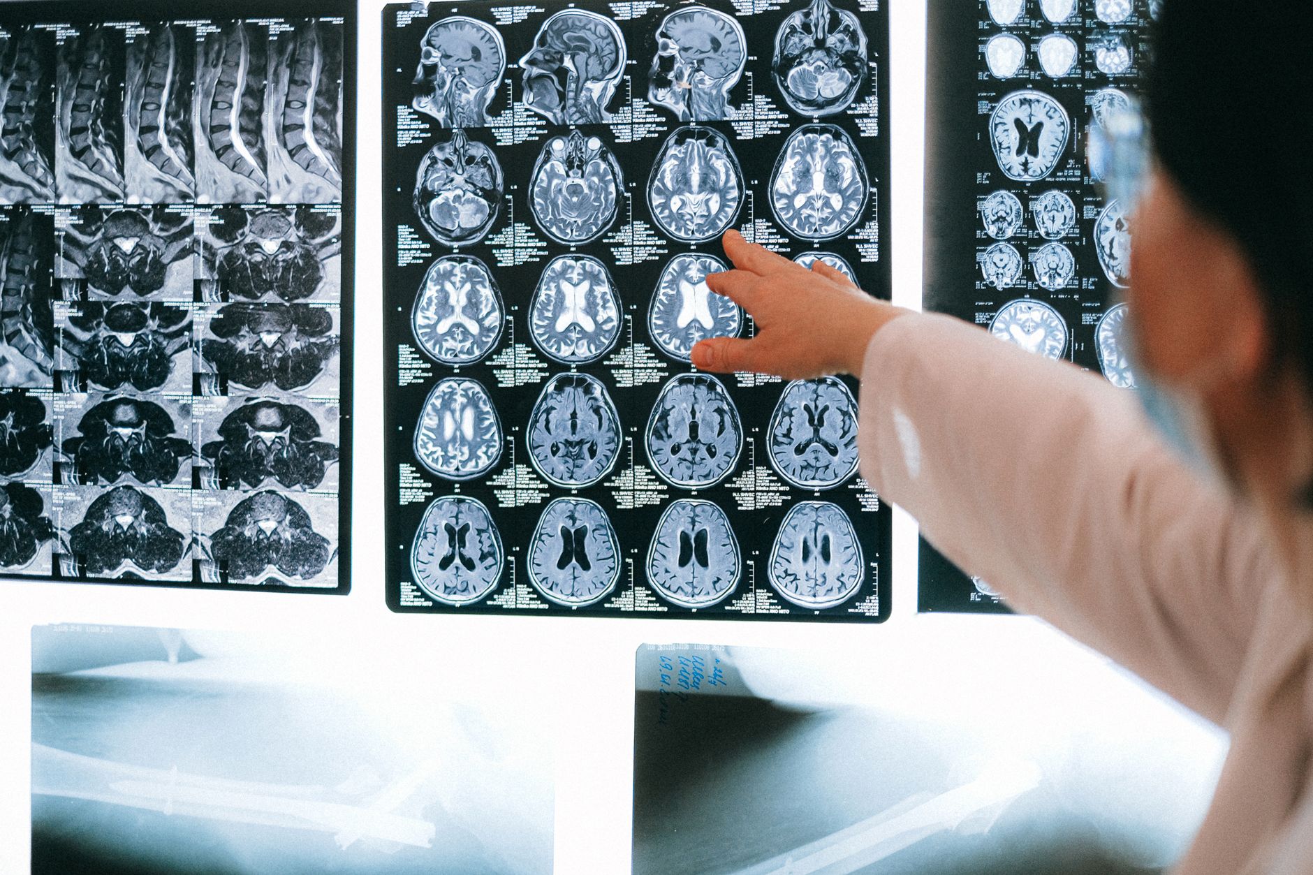 Neuroimaging Revolution: The Rise of Health System Learning