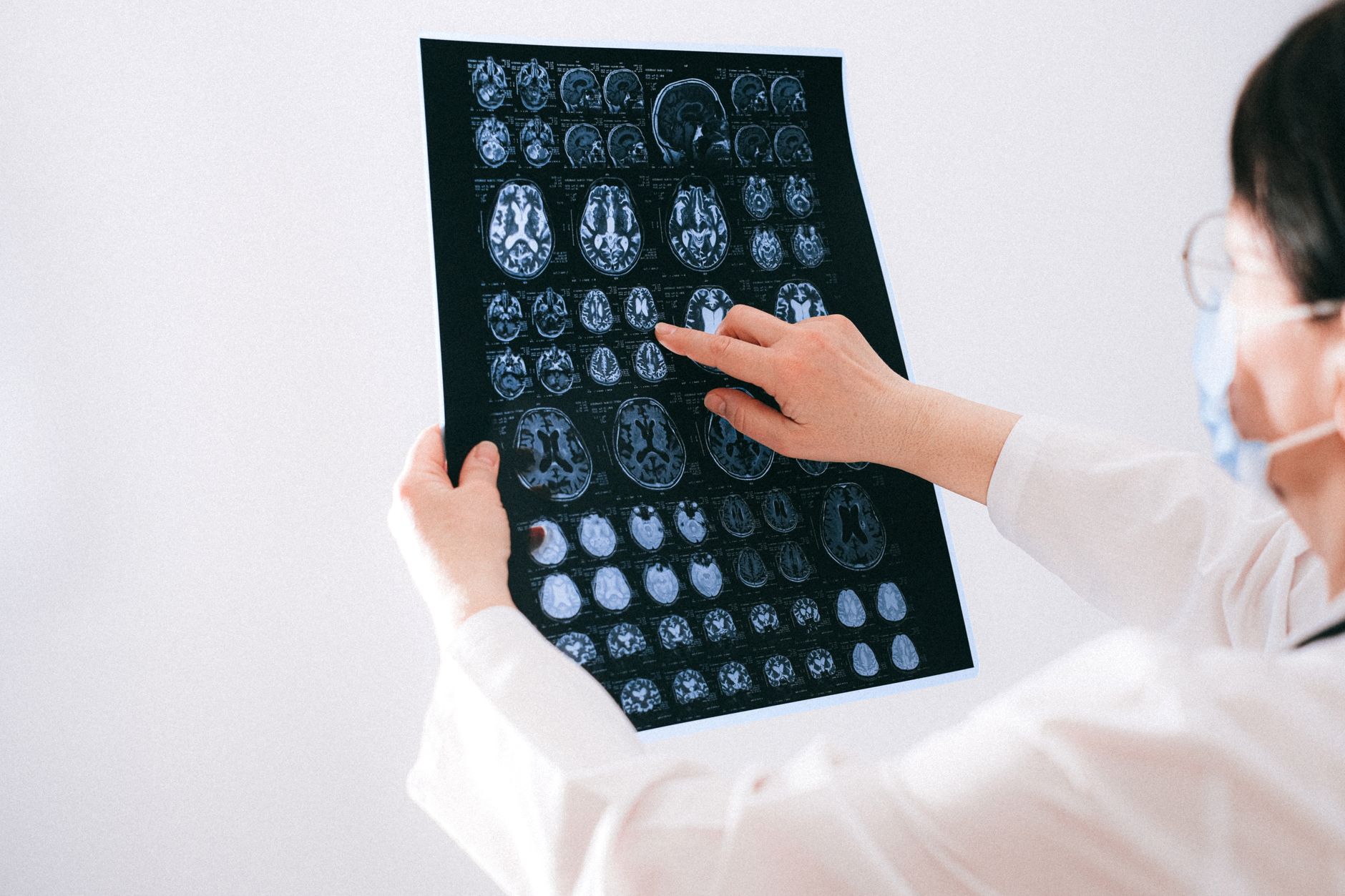 Decoding the Brain: How One Cell Becomes 170 Billion