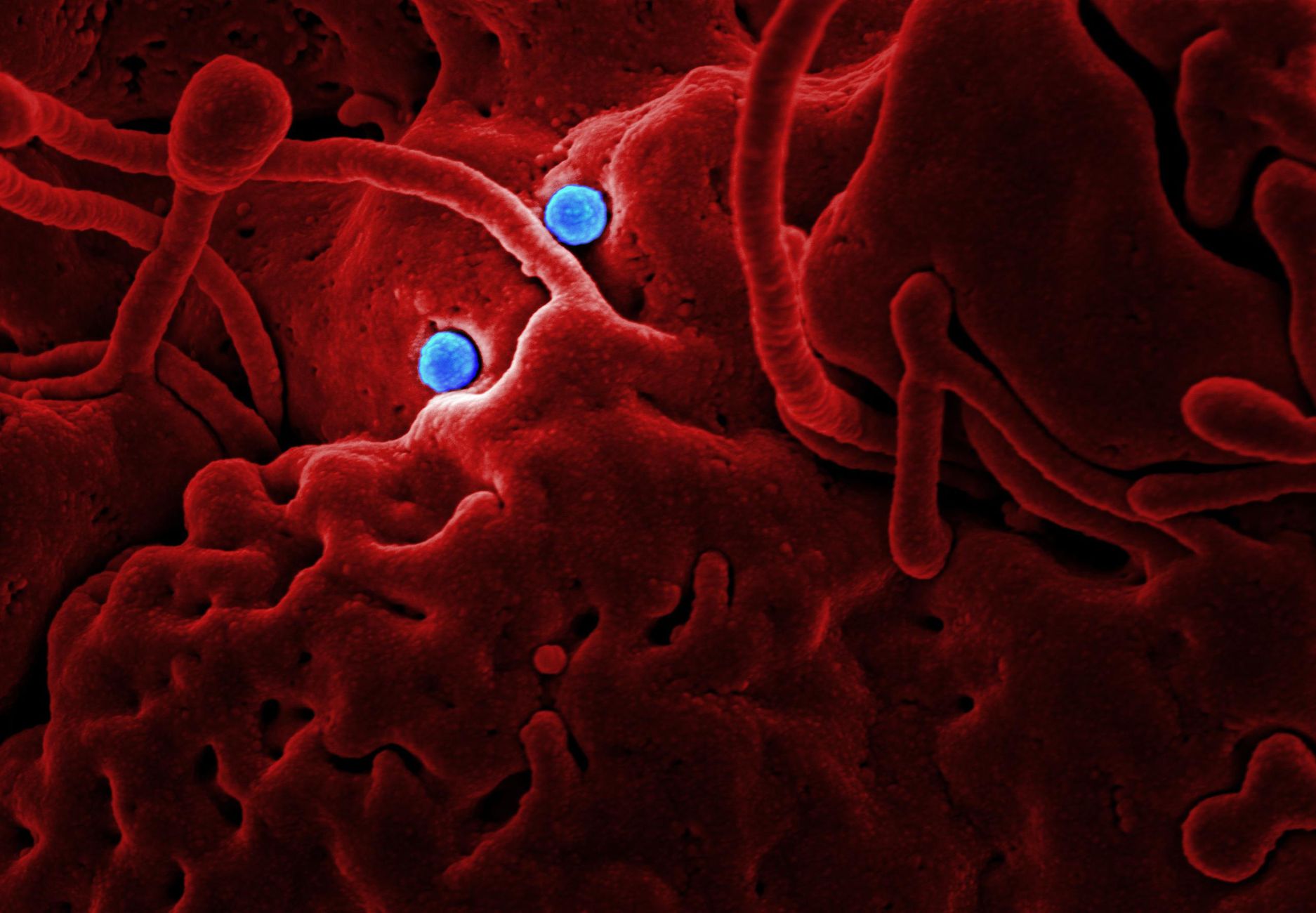 World Cup Fever: Infectious Diseases Pose Real Threat