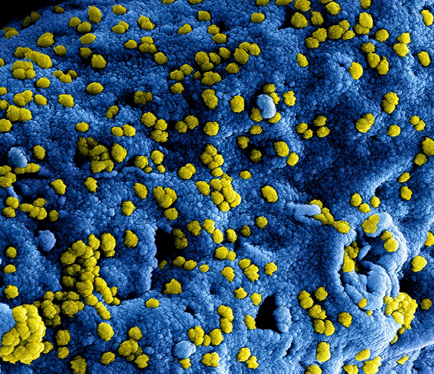 Ebola Outbreak Declared Global Emergency Amid Vaccine Challenges