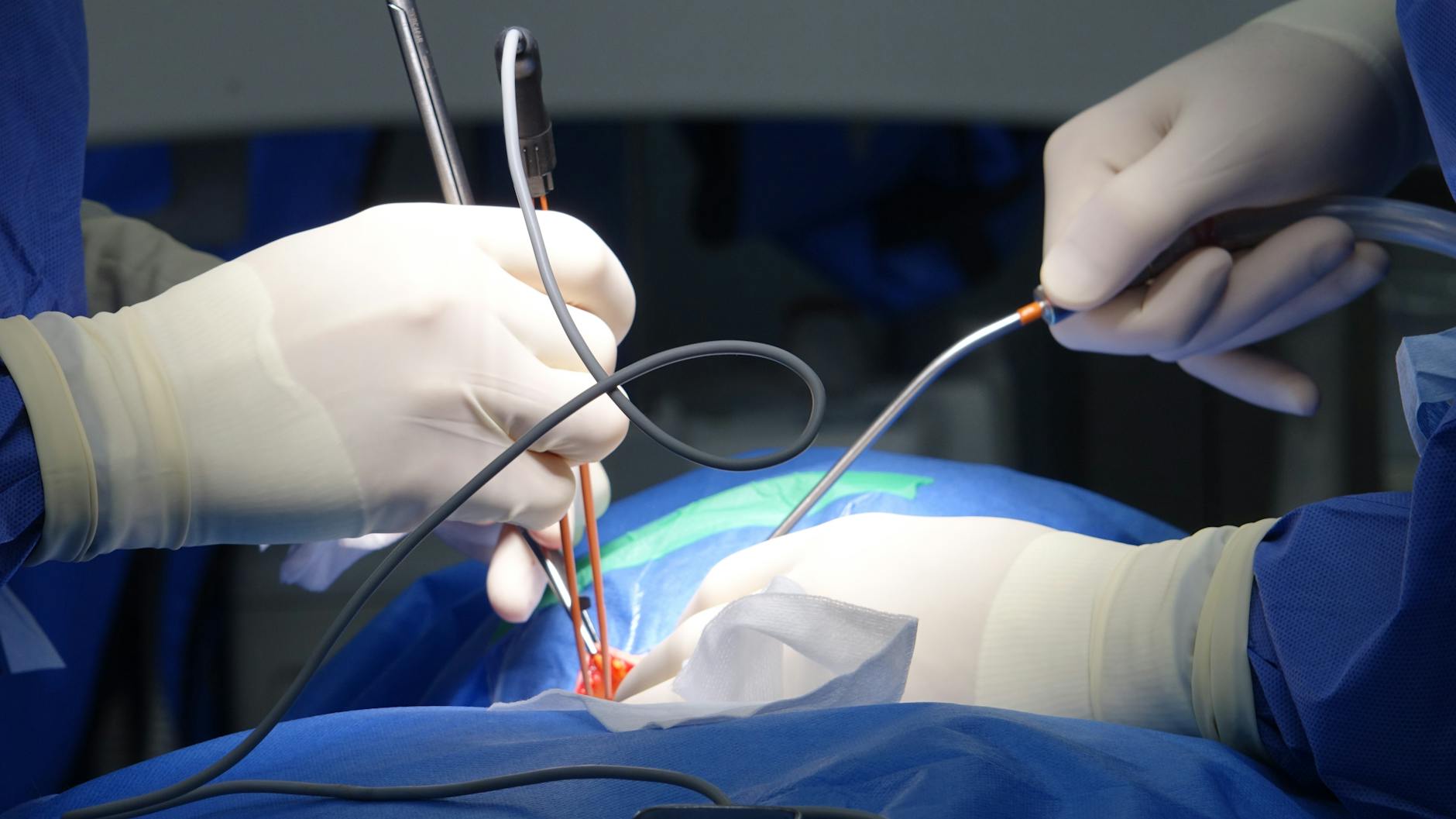 Robots in Surgery: The Future of Cancer Treatment
